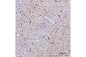 anti-Branched Chain Amino-Acid Transaminase 1, Cytosolic (BCAT1) (AA 88-386) antibody