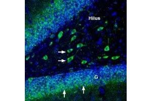 Immunohistochemistry (IHC) image for anti-ATPase, Na+/K+ Transporting, alpha 3 Polypeptide (ATP1A3) (AA 3-15), (Intracellular) antibody (ABIN7042962)