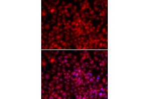 Immunofluorescence analysis of U2OS cells using ILF2 antibody. (ILF2 抗体)