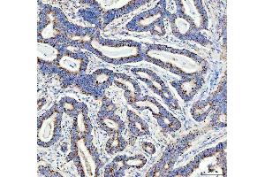 IHC analysis of DDX6 using anti-DDX6 antibody (ABIN7602044).