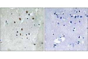 Immunohistochemistry analysis of paraffin-embedded human brain, using SRF (Phospho-Ser77) Antibody. (SRF 抗体  (pSer77))
