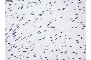 Immunohistochemical staining of paraffin-embedded liver tissue using anti-LOXmouse monoclonal antibody. (LOX 抗体  (AA 22-168))