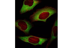 Fluorescent image of Hela cell stained with EIF4E Antibody (ABIN659032 and ABIN2838050)/SG101020AF. (EIF4E 抗体)
