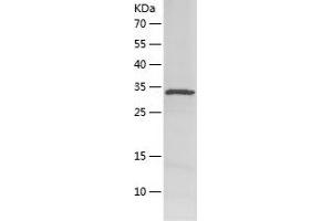 Western Blotting (WB) image for Fibronectin Type III Domain Containing 4 (FNDC4) (AA 45-148) protein (His-IF2DI Tag) (ABIN7122961)