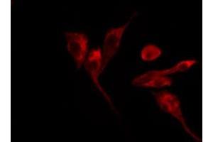 ABIN6269091 staining HepG2 by IF/ICC. (Integrin beta 3 抗体  (C-Term))
