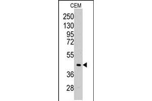 Western blot analysis of ALDOC polyclonal antibody  in CEM cell line lysates (35 ug/lane). (ALDOC 抗体  (C-Term))