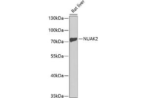 Western blot analysis of extracts of rat liver, using NU antibody (ABIN3021382, ABIN3021383, ABIN3021384 and ABIN6214981) at 1:1000 dilution. (NUAK2 抗体  (AA 523-672))