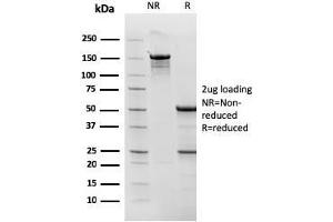 SDS-PAGE Analysis Purified Topo I, MT Mouse Monoclonal Antibody (TOP1MT/568). (TOP1MT 抗体)