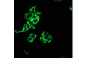 Immunofluorescence staining of PC-3 cells with ABIN7143505 at 1:100, counter-stained with DAPI. (ARL4C 抗体  (AA 2-192))