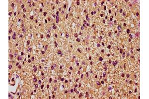 Immunohistochemistry (IHC) image for anti-Glial Fibrillary Acidic Protein (GFAP) (AA 292-432) antibody (ABIN7153853)