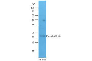 Lane 1: rat brain lysates probed with Rabbit Anti-RhoA(Ser188) Polyclonal Antibody, Unconjugated (ABIN758242) at 1:300 overnight at 4 °C. (RHOA 抗体  (pSer188))
