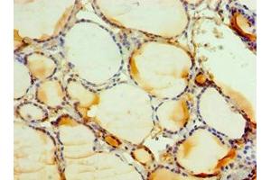 Immunohistochemistry of paraffin-embedded human thyroid tissue using ABIN7146163 at dilution of 1:100 (C3AR1 抗体  (AA 160-340))