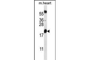 BCL2 Antibody (Center) (ABIN657744 and ABIN2846728) western blot analysis in mouse heart tissue lysates (35 μg/lane). (Bcl-2 抗体  (AA 86-114))