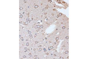 Immunohistochemistry (IHC) image for anti-Olfactory Receptor, Family 2, Subfamily S, Member 2 (OR2S2) (AA 200-300) antibody (ABIN7269087)