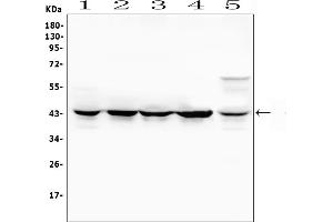 Western blot analysis of MAP2K4 using anti-MAP2K4 antibody (ABIN6719495). (MAP2K4 抗体  (AA 92-378))
