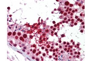 Immunohistochemistry (IHC) image for anti-KH Domain Containing, RNA Binding, Signal Transduction Associated 1 (KHDRBS1) (Middle Region) antibody (ABIN502004) (KHDRBS1 抗体  (Middle Region))