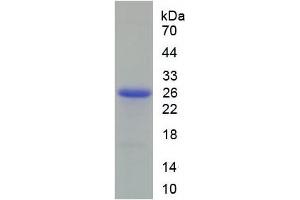 SDS-PAGE analysis of Rat Peroxiredoxin 6 Protein. (Peroxiredoxin 6 Protein (PRDX6))