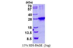 SIX Homeobox 6 Protein (SIX6) (His tag)