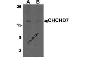 Western Blotting (WB) image for anti-Coiled-Coil-Helix-Coiled-Coil-Helix Domain Containing 7 (CHCHD7) (C-Term) antibody (ABIN1077411) (CHCHD7 抗体  (C-Term))