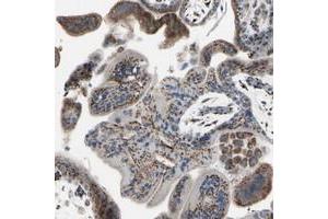 Immunohistochemical staining of human placenta with GLG1 polyclonal antibody  shows strong dot like cytoplasmic positivity in trophoblastic and decidual cells at 1:50-1:200 dilution. (GLG1 抗体)