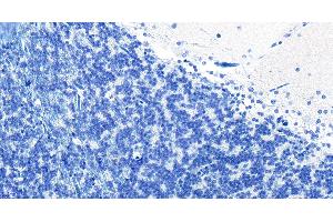 Immunohistochemistry (IHC) image for anti-Phosphatidylethanolamine Binding Protein 1 (PEBP1) (C-Term) antibody (ABIN184729)