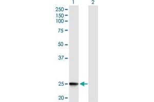 Western Blot analysis of IFNK expression in transfected 293T cell line by IFNK MaxPab polyclonal antibody. (IFNK 抗体  (AA 1-207))