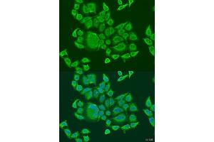 Immunofluorescence analysis of U2OS cells using DHX58 antibody (ABIN6129372, ABIN6139609, ABIN6139610 and ABIN6224272) at dilution of 1:100. (DHX58 抗体  (AA 389-678))