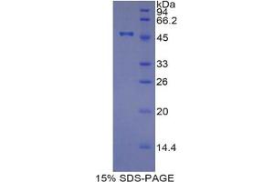 SDS-PAGE analysis of Pig TIMP4 Protein. (TIMP4 蛋白)