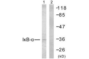 Western blot analysis of extracts from MCF7 cells using IκB-α (Ab-32/36) antibody (E021122). (NFKBIA 抗体)