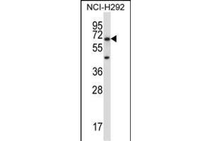 PODXL2 Antibody (C-term) (ABIN657525 and ABIN2846547) western blot analysis in NCI- cell line lysates (35 μg/lane). (PODXL2 抗体  (C-Term))