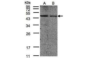 WB Image Sample(30 μg of whole cell lysate) A:293T B:A431, 12% SDS PAGE antibody diluted at 1:200 (EIF4A2 抗体  (N-Term))