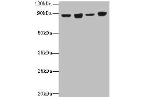 Western blot All lanes: DDX50 antibody at 4 μg/mL Lane 1: Hela whole cell lysate Lane 2: Jurkat whole cell lysate Lane 3: K562 whole cell lysate Lane 4: 293T whole cell lysate Secondary Goat polyclonal to rabbit IgG at 1/10000 dilution Predicted band size: 83 kDa Observed band size: 83 kDa (DDX5 抗体  (AA 1-210))