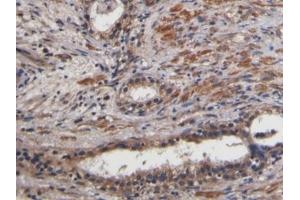 Immunohistochemistry (IHC) image for anti-Connective Tissue Growth Factor (CTGF) (AA 80-200) antibody (ABIN7437947)