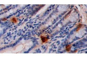 Immunohistochemistry (IHC) image for anti-5-Hydroxytryptamine (5-HT) antibody (ABIN7429649)