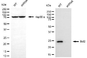 Western blotting analysis using Bcl2 antibody (ABIN7797721). (Recombinant Bcl-2 抗体)