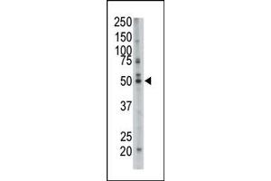 Western Blotting (WB) image for anti-Farnesyl-Diphosphate Farnesyltransferase 1 (FDFT1) (N-Term) antibody (ABIN357711)