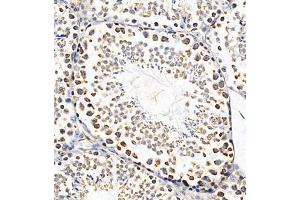 Immunohistochemistry of paraffin embedded mouse testis using PTPN3 (ABIN7075298) at dilution of 1:700 (300x lens) (PTPN3 抗体)