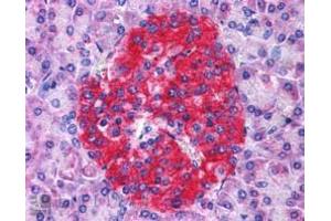 ABIN184686 (3. (Annexin a10 抗体  (N-Term))