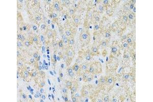 Immunohistochemistry of paraffin-embedded Human liver using SLC19A1 Polyclonal Antibody at dilution of 1:100 (40x lens). (SLC19A1 抗体)