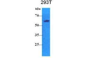 Western Blotting (WB) image for anti-Pyruvate Kinase, Liver and RBC (PKLR) antibody (ABIN781545) (PKLR 抗体)