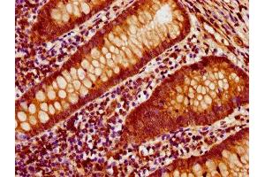Immunohistochemistry (IHC) image for anti-Actin, beta (ACTB) (AA 102-375) antibody (ABIN7143136)