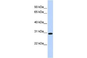 Western Blotting (WB) image for anti-Survival Motor Neuron Domain Containing 1 (SMNDC1) antibody (ABIN2458518) (SMNDC1 抗体)