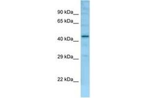 Image no. 1 for anti-Family with Sequence Similarity 170, Member B (FAM170B) (AA 251-300) antibody (ABIN6748441) (FAM170B 抗体  (AA 251-300))