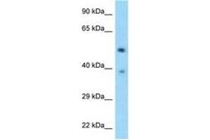 Image no. 1 for anti-tRNA-splicing Endonuclease Subunit SEN2 (TSEN2) (AA 395-444) antibody (ABIN6748165) (TSEN2 抗体  (AA 395-444))