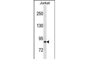 ZN Antibody (C-term) (ABIN1882021 and ABIN2838604) western blot analysis in Jurkat cell line lysates (35 μg/lane). (ZNF337 抗体  (C-Term))