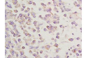 Immunohistochemistry (Paraffin-embedded Sections) (IHC (p)) image for anti-Golgi-Associated, gamma Adaptin Ear Containing, ARF Binding Protein 2 (GGA2) (AA 161-260) antibody (ABIN1714802)