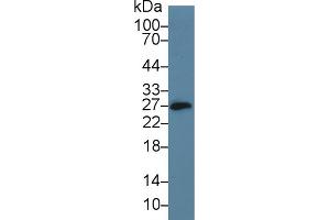 Western Blot; Sample: Mouse Small intestine lysate; Primary Ab: 5µg/ml Rabbit Anti-Mouse CD160 Antibody Second Ab: 0. (CD160 抗体  (AA 33-171))
