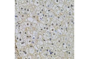 Immunohistochemistry of paraffin-embedded human liver injury using NRF1 Antibody (ABIN6290682) at dilution of 1:100 (40x lens). (NRF1 抗体)