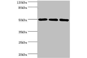 Western blot All lanes: ZMYND10 antibody at 8 μg/mL Lane 1: A549 whole cell lysate Lane 2: Mouse kidney tissue Lane 3: Mouse skeletal muscle tissue Secondary Goat polyclonal to rabbit IgG at 1/10000 dilution Predicted band size: 51, 50 kDa Observed band size: 51 kDa
