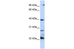 WB Suggested Anti-TNFRSF10B Antibody Titration:  0. (TNFRSF10B 抗体  (N-Term))